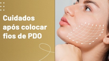 Cuidados após colocar fios de PDO