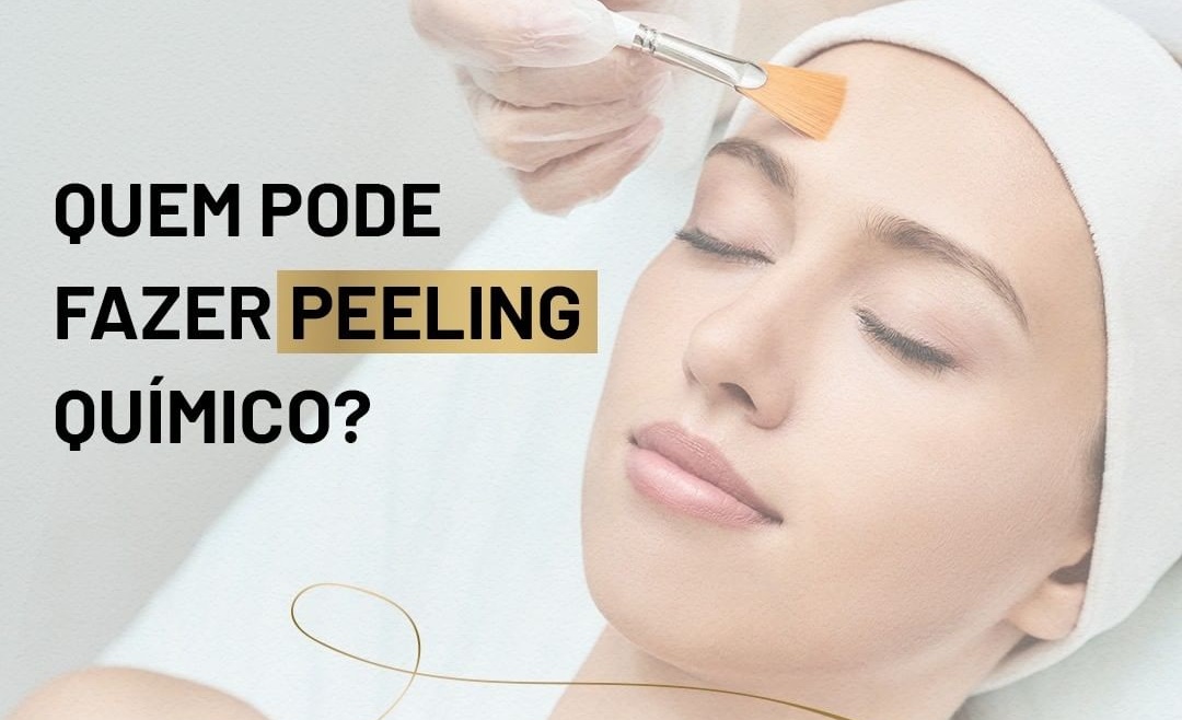 Quem pode fazer peeling químico?